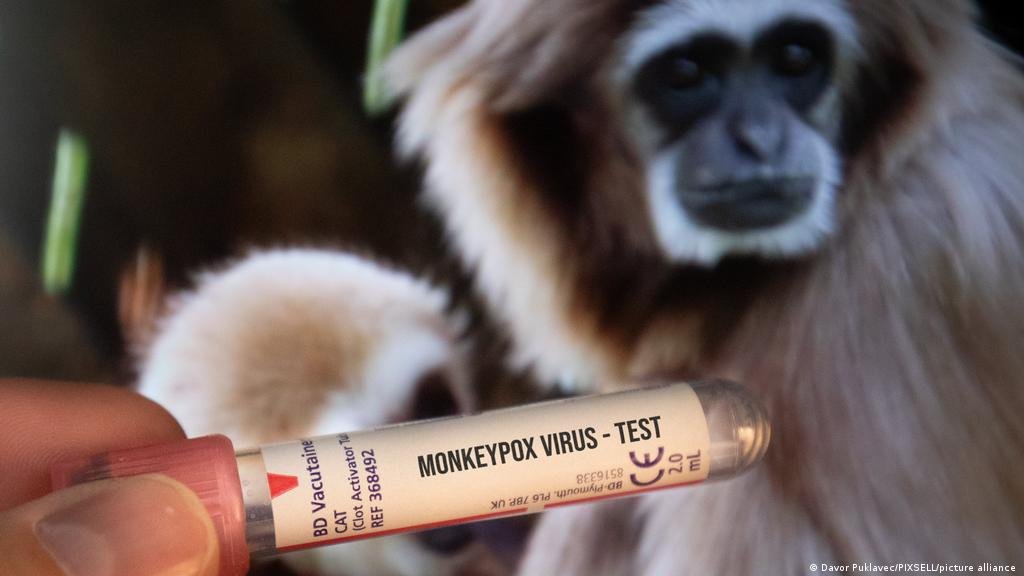АНУ-д сармагчны цэцэг өвчний тохиолдлын тоо 20 мянга давжээ