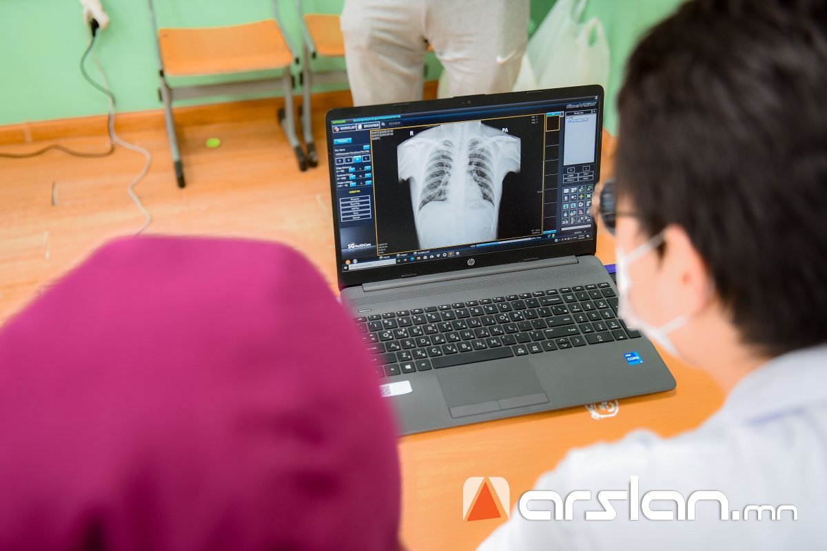 ХӨСҮТ: БЗД, ХУД-т сүрьеэгийн идэвхтэй илрүүлэлтийн үзлэг, оношилгоог энэ сарын 23-наас эхлүүлнэ