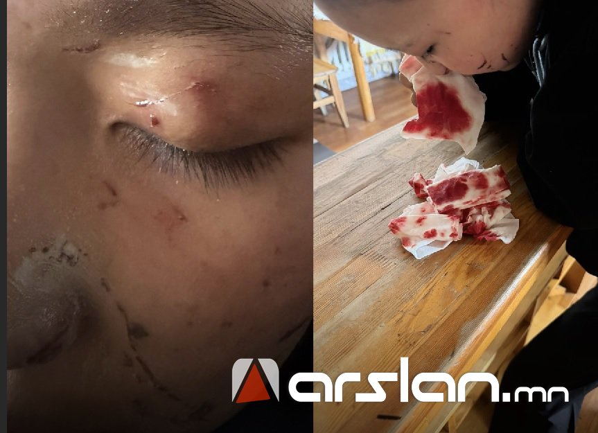 ЕБС-ийн 9-р ангийн сурагч охин бие засах нэрийдлээр 11-р ангийн сурагчийг дуудаж, зодсон хэрэг гарчээ