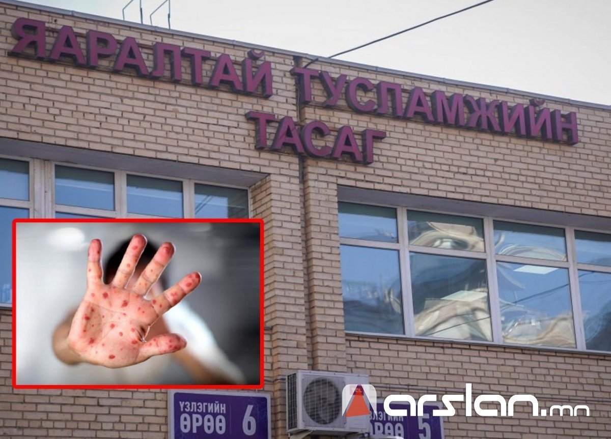 Улаанбурханы батлагдсан тохиолдлын тоо 15,004 болж, энэ сарын 8-нд НЭГ ХҮН НАС БАРЖЭЭ